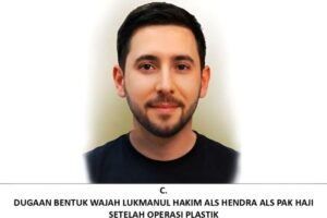 Polisi Ajukan Red Notice Interpol Untuk Lukmanul Hakim, Bandar Narkoba Diduga Operasi Plastik Dan Ganti Kewarganegaraan