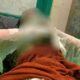 Perempuan Dibakar Mantan Suami Di Kobar, Korban Alami Luka Bakar Serius