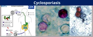 Michigan Mengalami Wabah Siklosporiasis, Dua Orang Meninggal