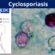 Michigan Mengalami Wabah Siklosporiasis, Dua Orang Meninggal