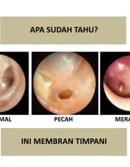 Tragedi Sopir Truk Terbakar Di Bali: 68% Luka Bakar, Kematian, Dan Dampak Sosial